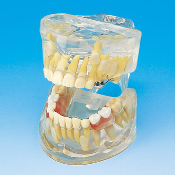 dental surgery microscope  03