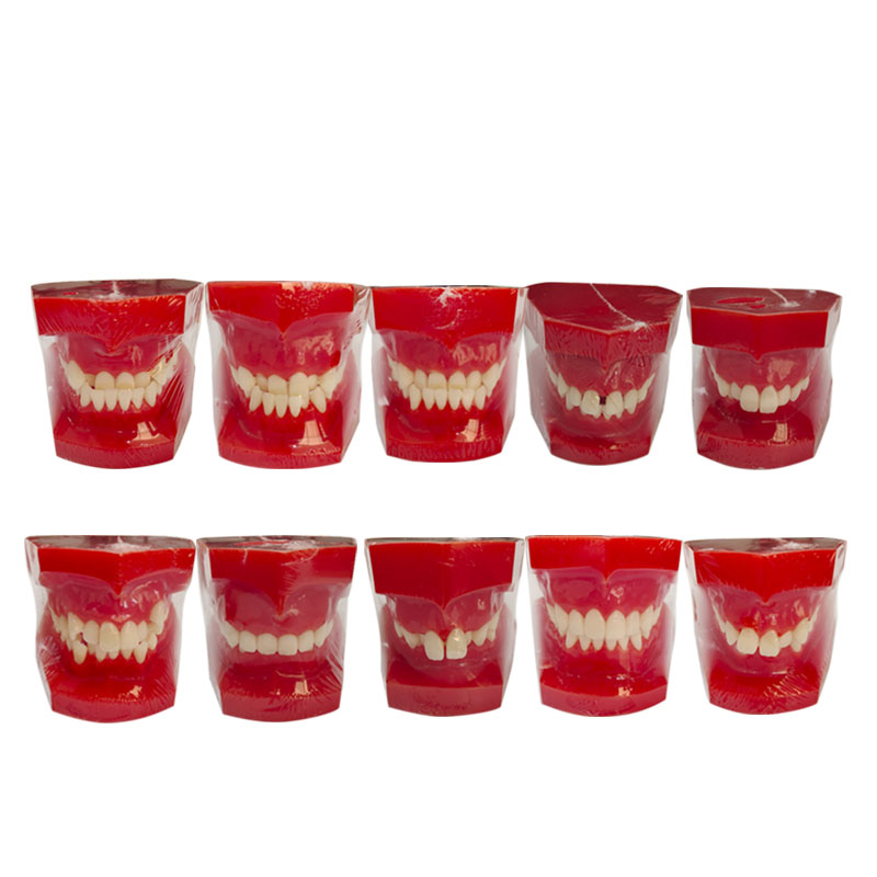 UM-S10C Orthodontic Classification Model (Red)