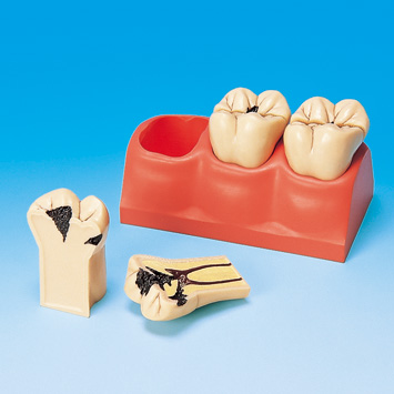 dental surgery microscope  03