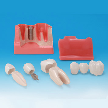 dental surgery microscope  03