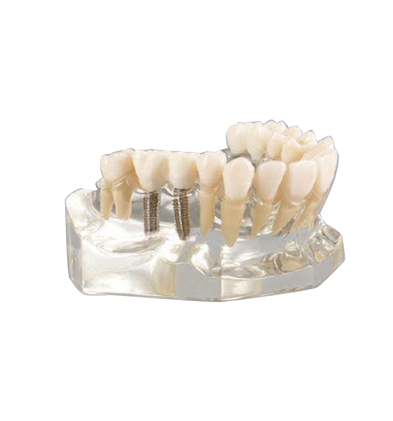 UM-2011 Maxillary Model