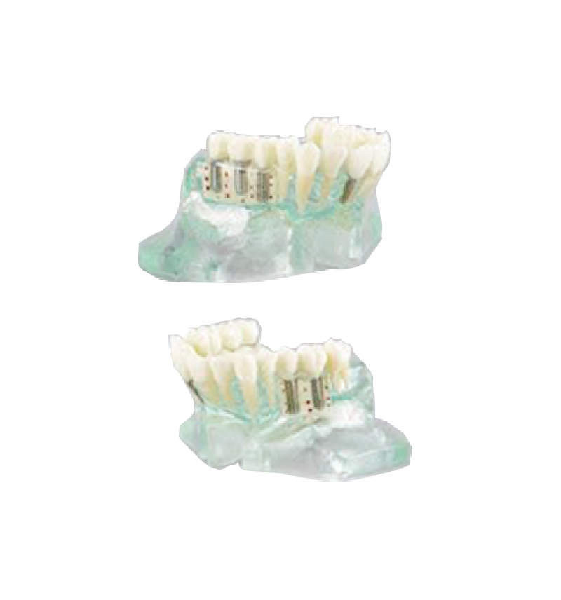 dental surgery microscope  03