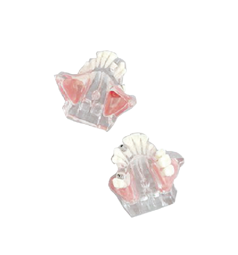 dental surgery microscope  03