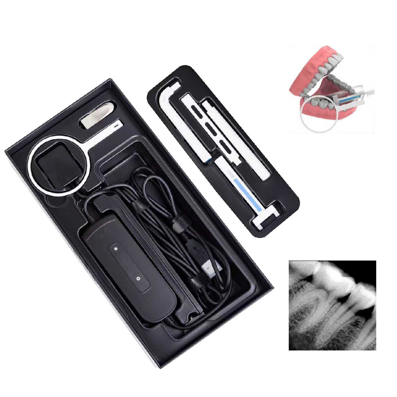 dental surgery microscope  03