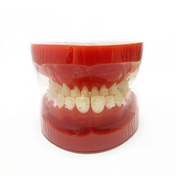 UM-B8 Orthodontic Model (Ceramic Brackets)