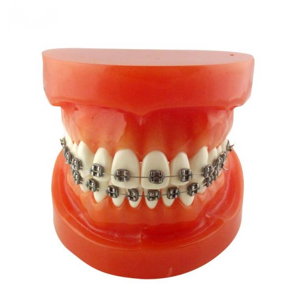 UM-B9 Orthodontic Model