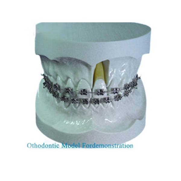 UM-S11 Orthodontic Model For Demonstration With Edgewise Bracket
