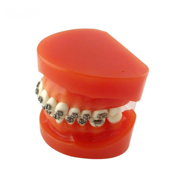UM-B9 Orthodontic Model (metal brackets)