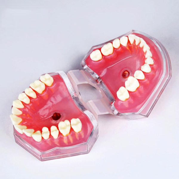 UM-7008 Soft Gum With Removable Teeth