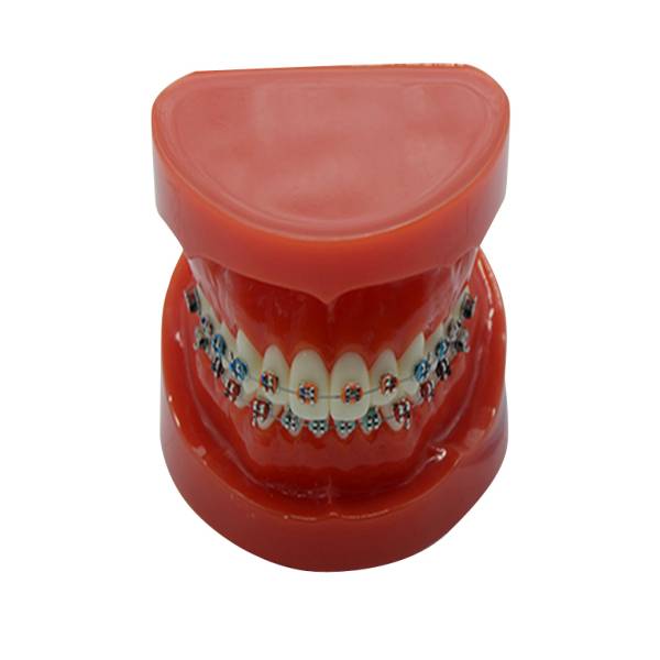 UM-B16 Study Model With Fixed Braces On Teeth(normal)
