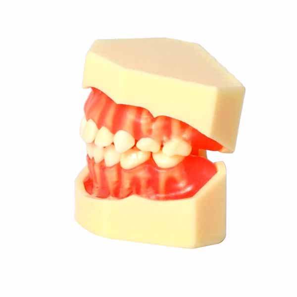 UM-7009 Removable Child Dentition Model (20 Removable Teech)