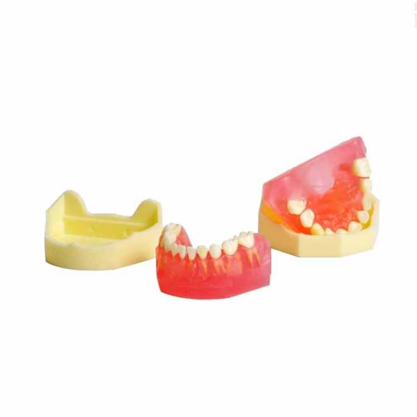 UM-7009 Removable Child Dentition Model (20 Removable Teech)