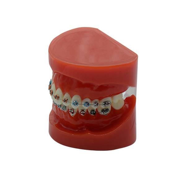 UM-B16 Study Model With Fixed Braces On Teeth(normal)