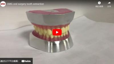 UMG Oral Surgery Tooth Extraction