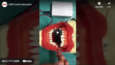 UMG Tooth Extraction