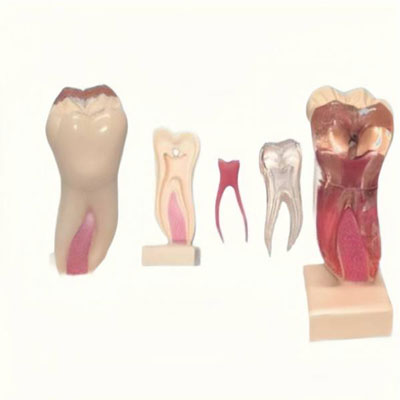 The Details of Um-aa1 Anatomic Profile Model of the Mandibular Molar(6 Times the Natural Size)
