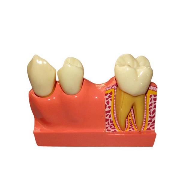 Um-d2 4 Times Sized the Model of Jaw Bone Disassembling