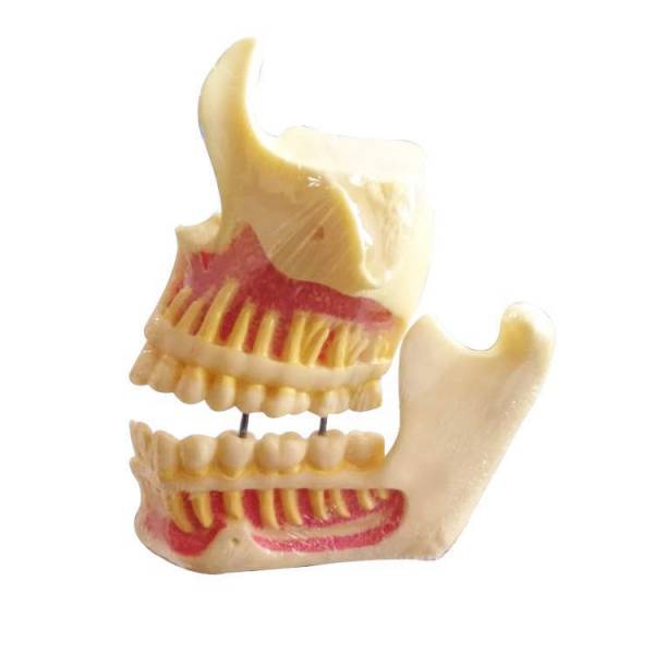 The Details of Um-f1 Educational Models of Upper Jaw and Mandible
