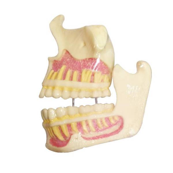 Um-f1 Educational Models of Upper Jaw and Mandible