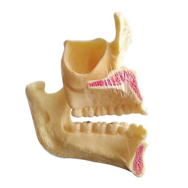 The Details of Um-f1 Educational Models of Upper Jaw and Mandible