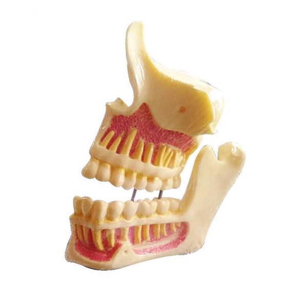 Um-f1 Educational Models of Upper Jaw and Mandible