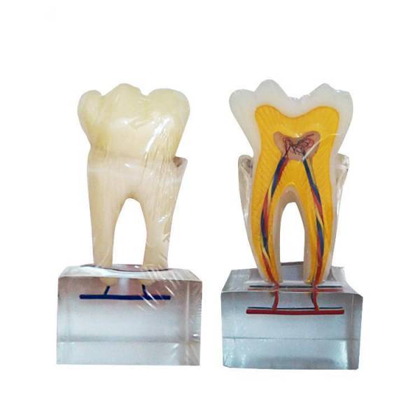 UM-U14 Six Times Normal Tooth Anatomy Model