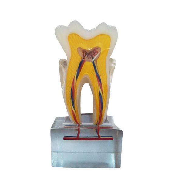The Details of Um-u14 Six Times Normal Tooth Anatomy Model