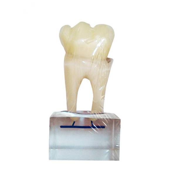 The Details of Um-u14 Six Times Normal Tooth Anatomy Model