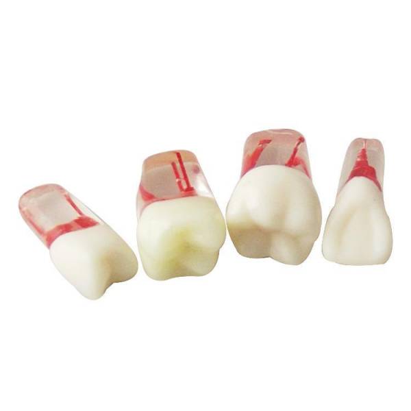 The Details of Um-ls12 Root Canal Model