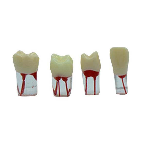 The Details of Um-ls12 Root Canal Model