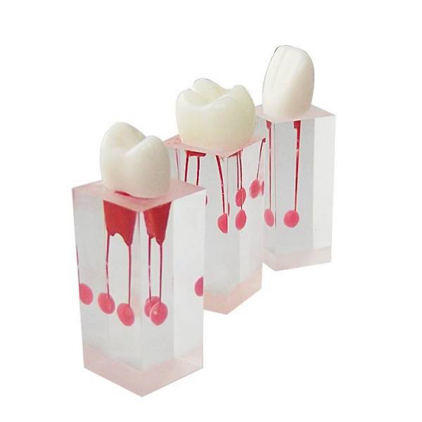 Um-ls3 Root Canal Model