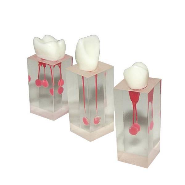 Um-ls3 Root Canal Model