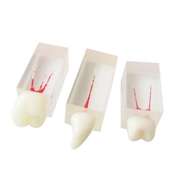 Um-ls7 Root Canal Model