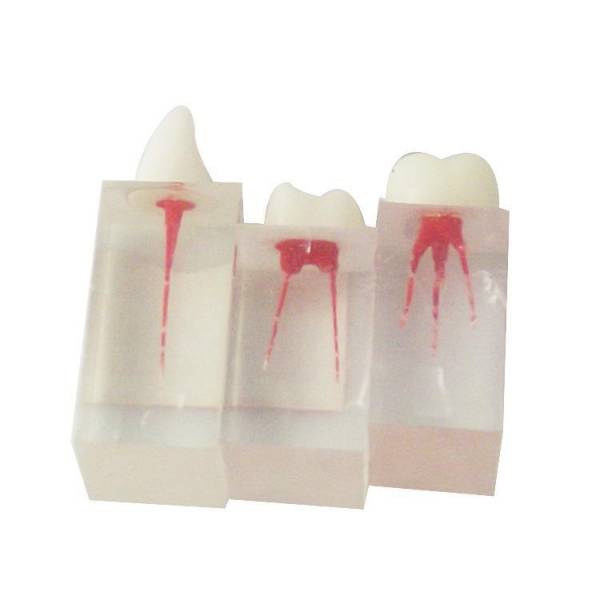 Um-ls7 Root Canal Model