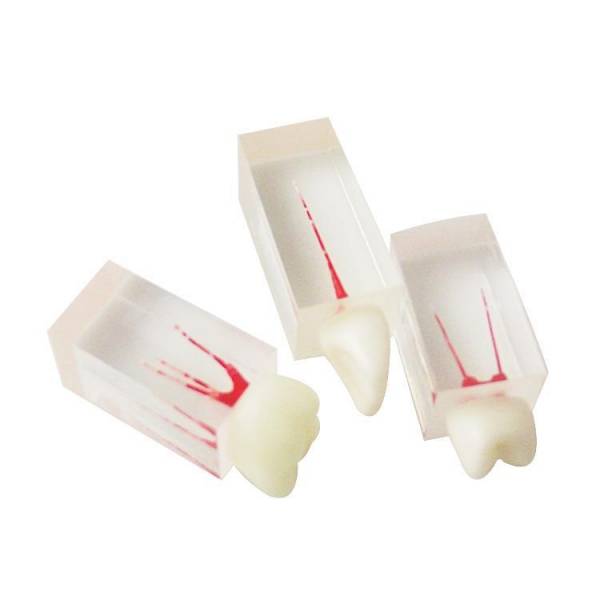 The Details of Um-ls7 Root Canal Model