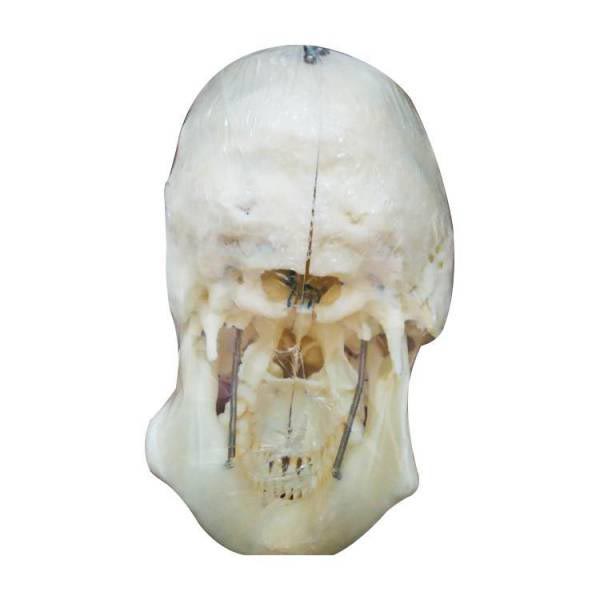 Um-f9 Human Skull Reconstucted Model(divided in to 10 Parts)