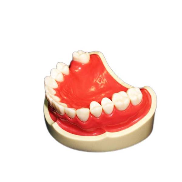 The Details of Um-ht2 Teeth Missing with Silicone Rubber
