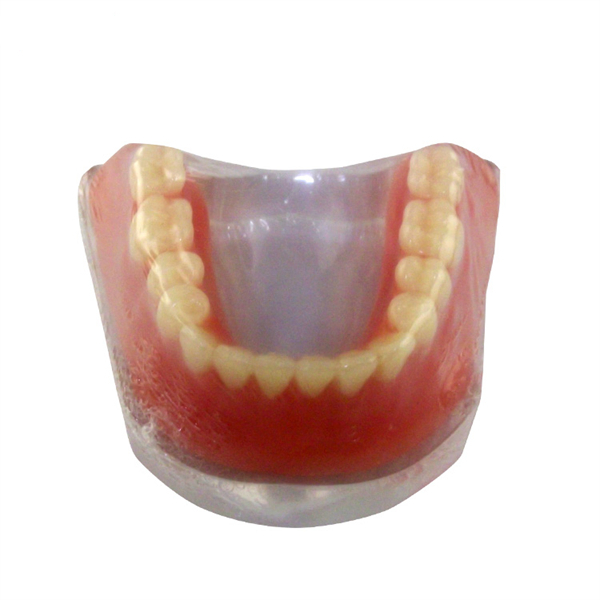 Patient Communication for Teaching Displaying Studying 2 Implants Demo Dental Overdenture Inferior Model 