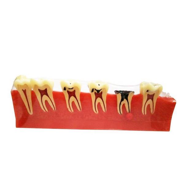 UM-E8 Periodontal Diseases Classification Model