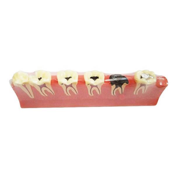 UM-E8 Periodontal Diseases Classification Model