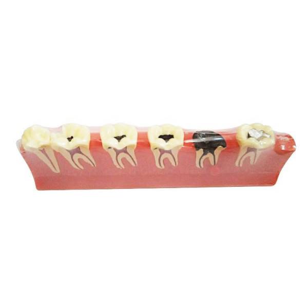 ​The Details of UM-E8 Periodontal Diseases Classification Model
