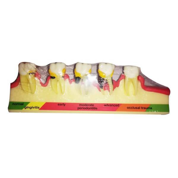 Um-e9 Periodontal Diseases Classification Model