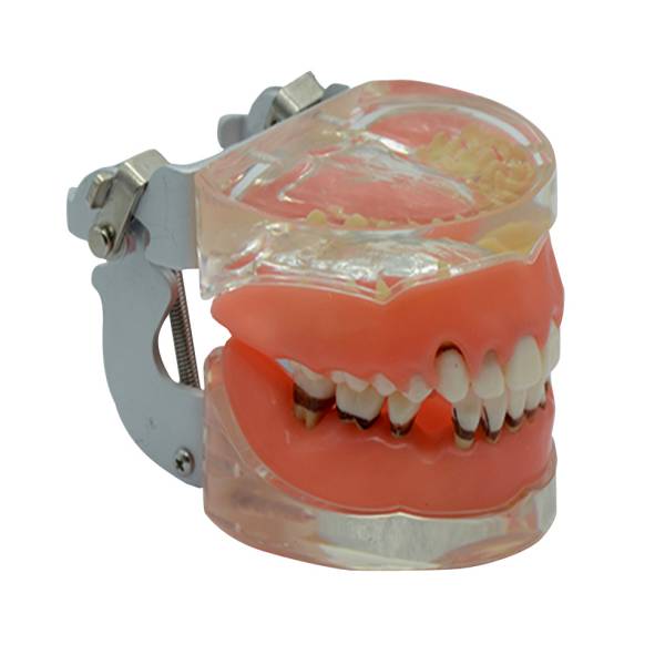 Um-s9 Gingival Disease Model