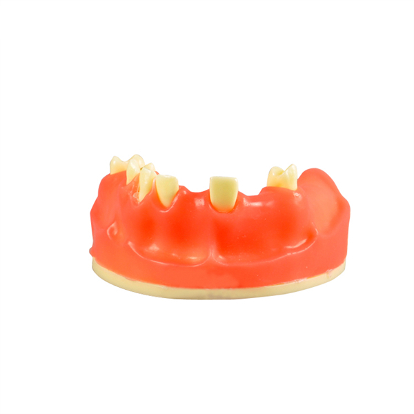 Ultrassist Dental Implant Training Practice Maxillary Model with Sinus Basic Implant Training Model with Practice Soft Gums Great Dental Training Tooth for Dental Implant Practice 