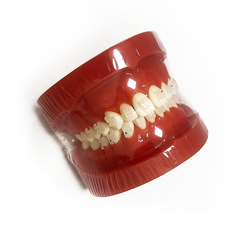 UM-B8 Orthodontic Model (Ceramic Brackets)