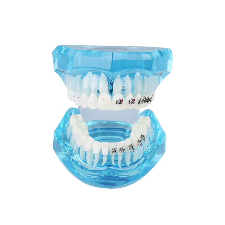 UM-B21 Transparent Dentition With Brackets