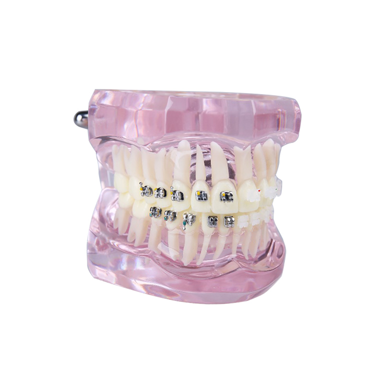 UM-B21 Transparent Dentition With Brackets