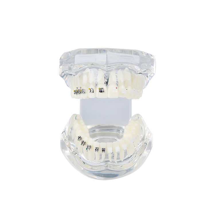 UM-B21 Transparent Dentition With Brackets