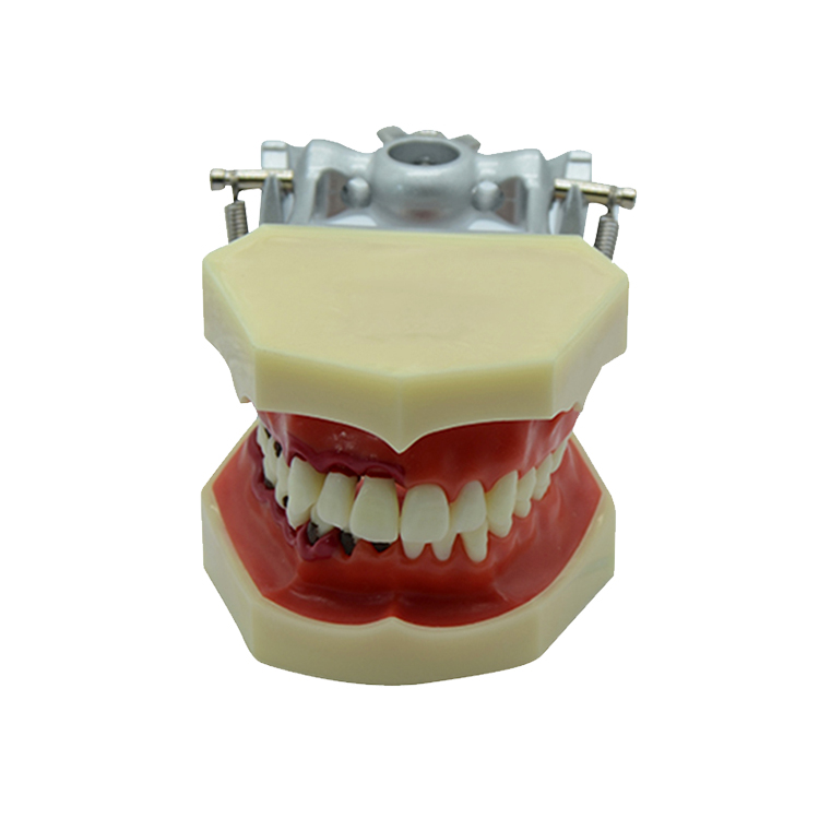 UM-4025 Periodontal Model