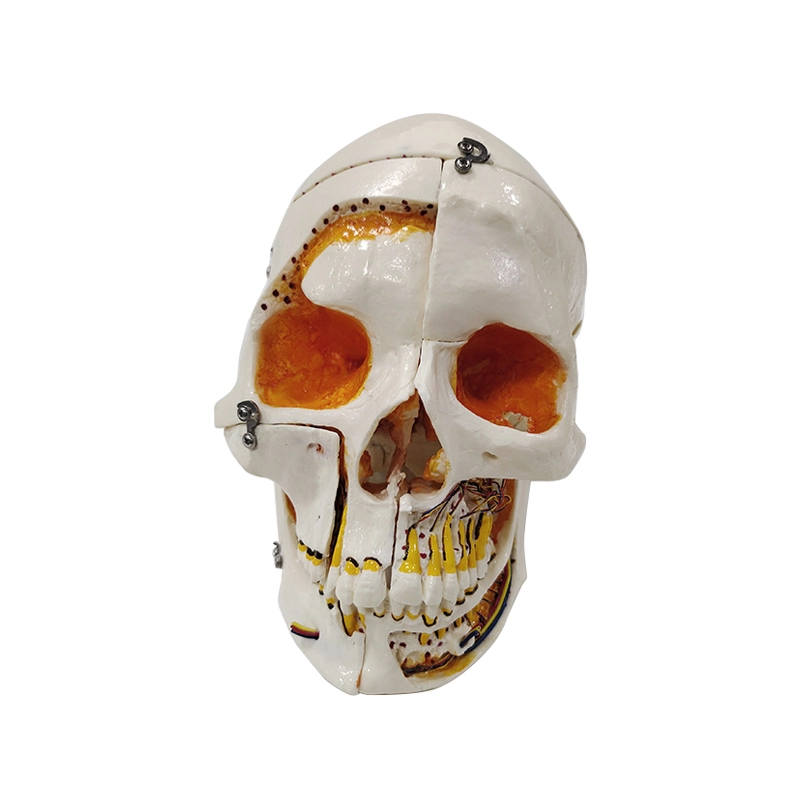 UM-F5011 Human Skull Reconstucted Model(divided in to 10 Parts)